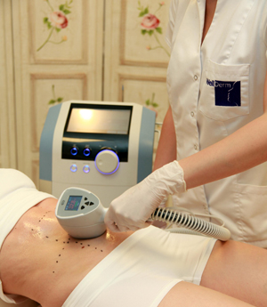 Exilis
