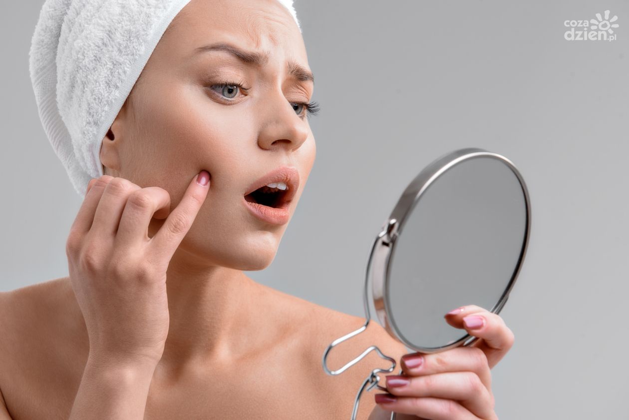 Jak dbać o cerę trądzikową?