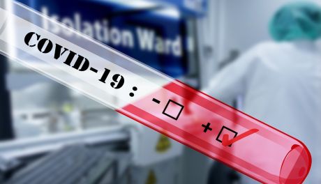 Wpływ wirusa SARS-CoV-2 na parametry nasienia 