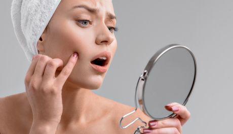 Jak dbać o cerę trądzikową?